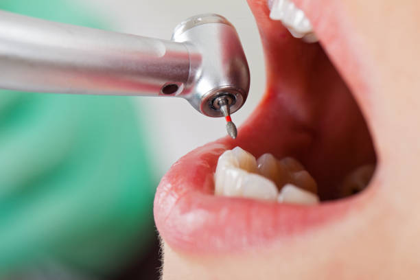 Best Emergency Dental Services for Seniors in Orida Gulf Coast University, FL